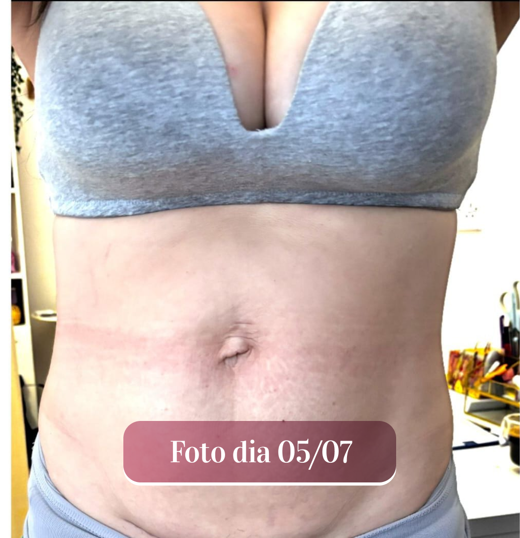 Antes