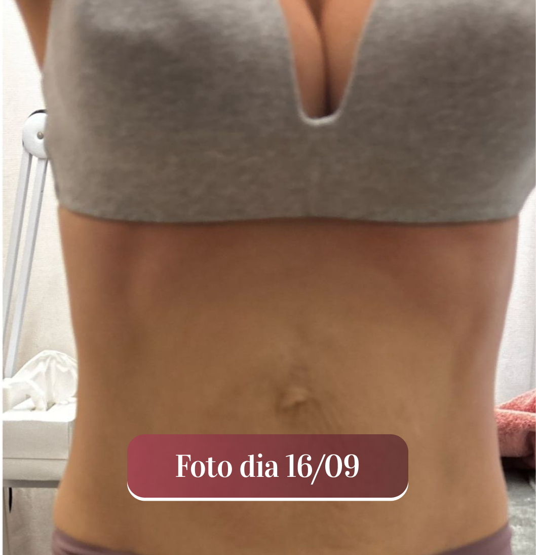 Depois